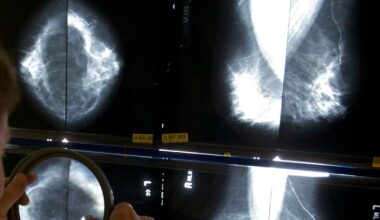 Health Canada approves drug that treats hot flashes for use by breast cancer patients - CTV News