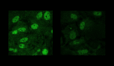 Three models, three routes to altered auditory processing, and more