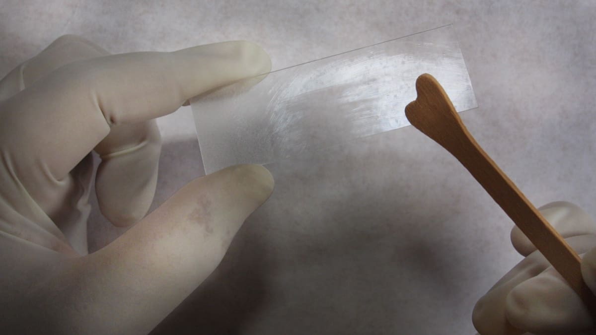 Cervical screening: Almost one million notifications not sent, review finds