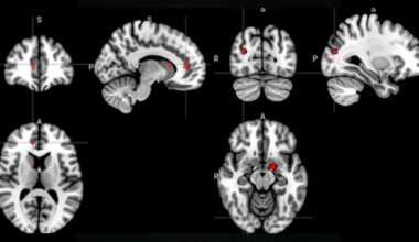 Acupuncture Seems to Rewire The Brain in Depression, Scans Reveal : ScienceAlert