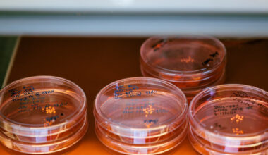 New milestone for stem cell research: Lab-grown brain ‘organoids’ set longevity record