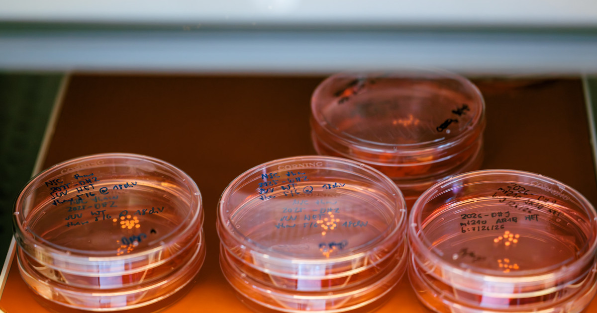 New milestone for stem cell research: Lab-grown brain ‘organoids’ set longevity record