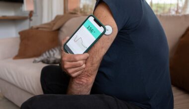 I wore a glucose monitor for 30 days. This is what I learned about my diet and exercise – The Irish Times
