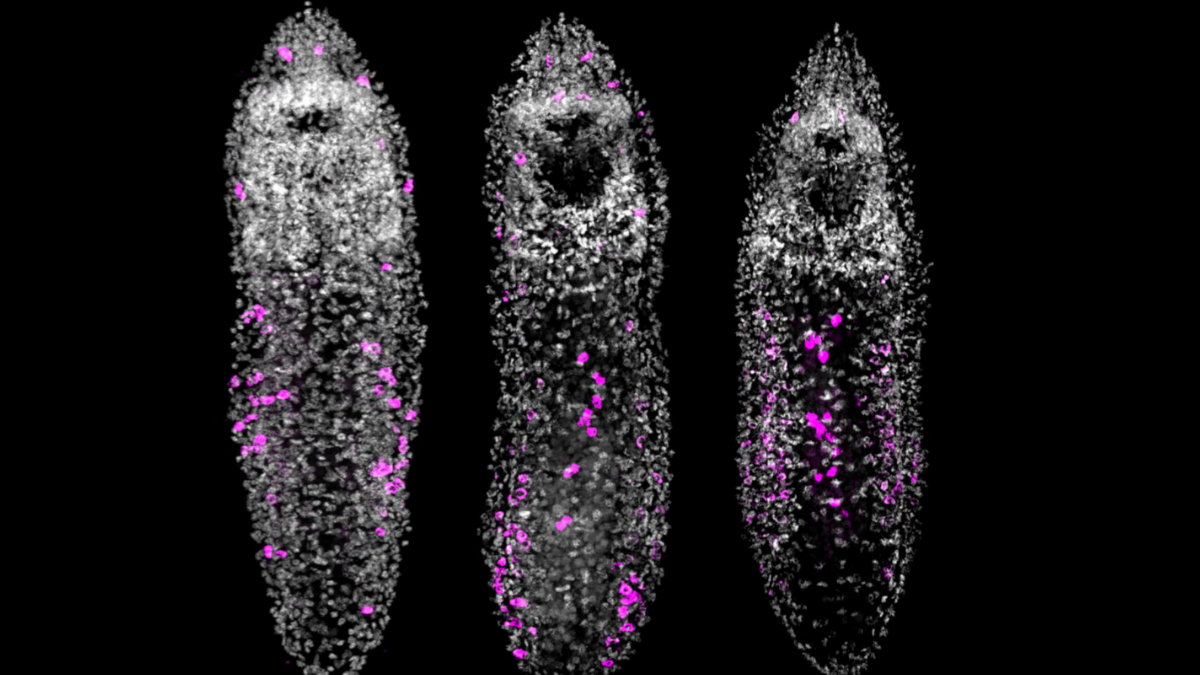 Scientists Overfed a Tiny Worm... And It Started Growing a Chain of Clones : ScienceAlert