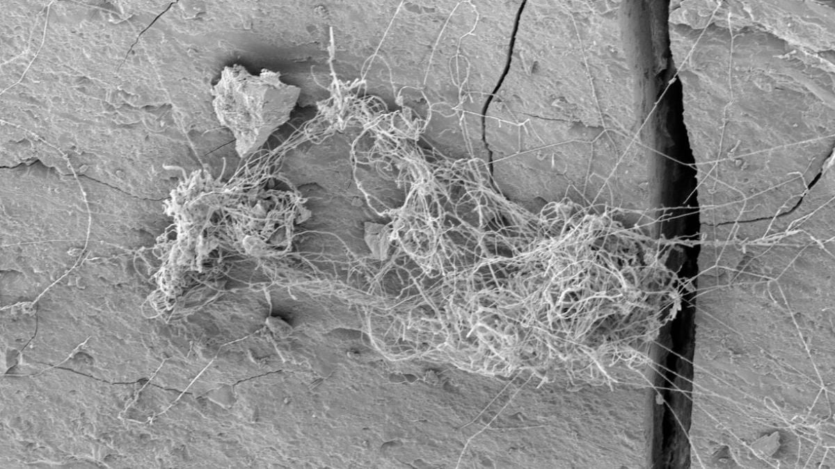 Ecosystems of Rock-Eating Fungus And Tardigrades Found Thriving Deep Within a Gas Shale : ScienceAlert