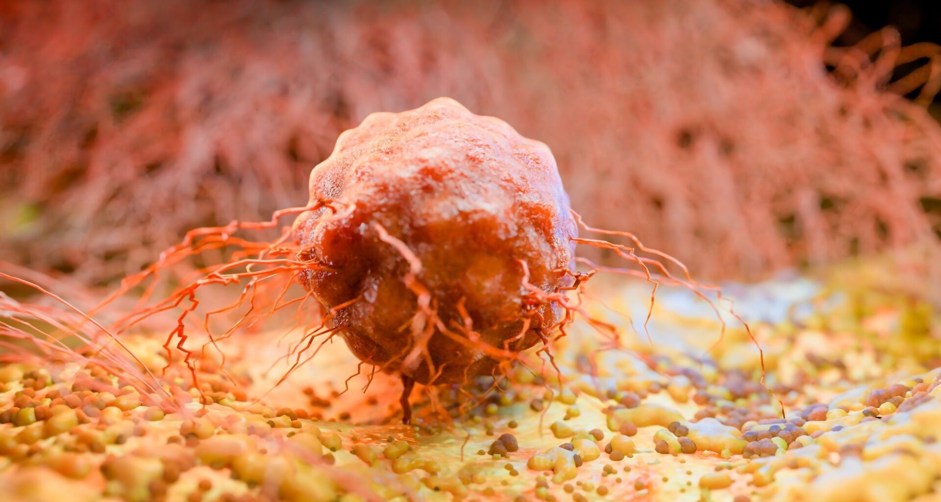 Circadian Oncology: Timing, Cancer Treatment, and Patient Outcomes