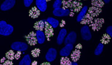 Toxoplasma parasites are shown in green, with host and parasite nuclei in blue. The iron-sulfur cluster assembly protein ISCU, shown in magenta, localizes to the parasite mitochondria and highlights their structure. ISCU is one of the targets regulated by TgPRO. [Whitehead Institute/Lourido Lab]