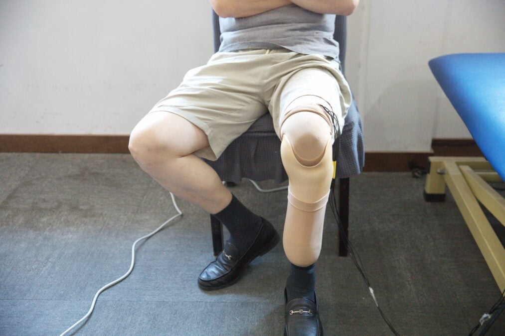 A lower-limb amputee sitting on a chair while wearing a sensor-integrated prosthesis.