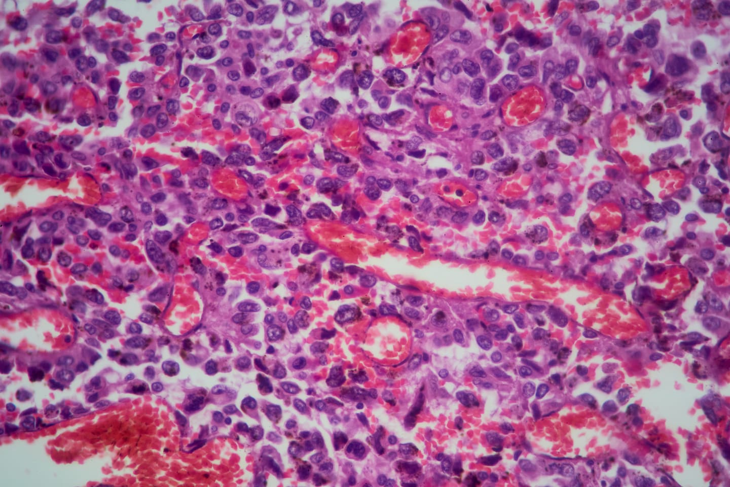 Some cancers are being detected too late. Here’s what experts advise.