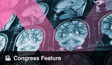 Advancing AI-Driven Clinical Decision Support in Acute Stroke
