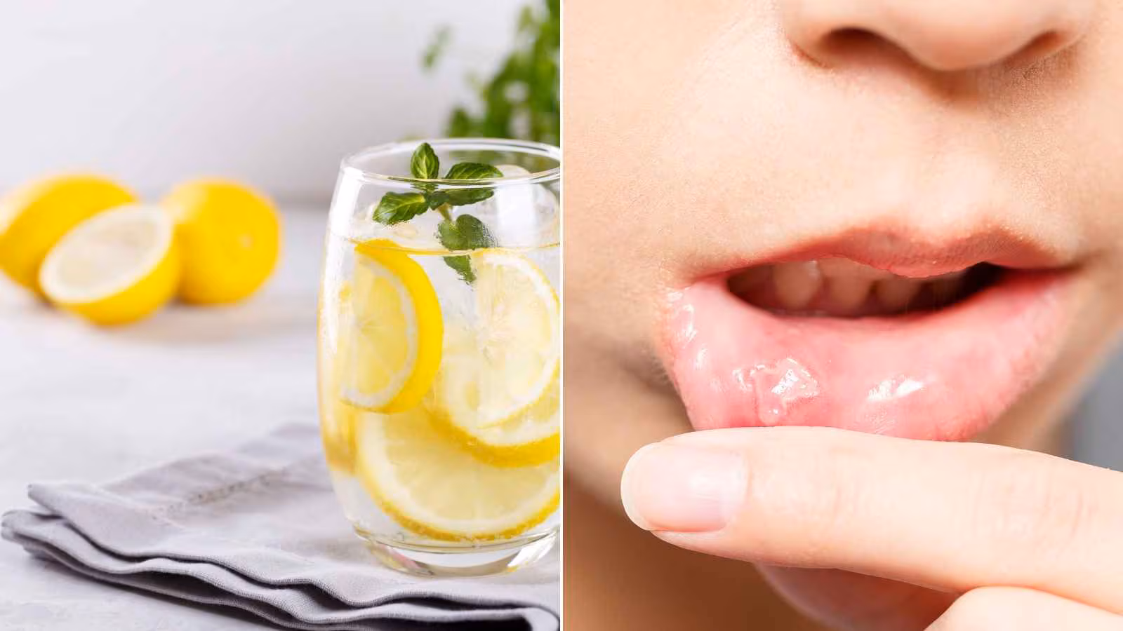 People dealing with mouth ulcers or sores should avoid drinking lemon water until they recover. The acidic content of lemon can irritate the affected area, leading to a burning sensation and making the healing process more uncomfortable. People dealing with mouth ulcers or sores should avoid drinking lemon water until they recover. The acidic content of lemon can irritate the affected area, leading to a burning sensation and making the healing process more uncomfortable.