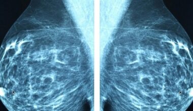 New dual-drug strategy blocks triple-negative breast cancer growth