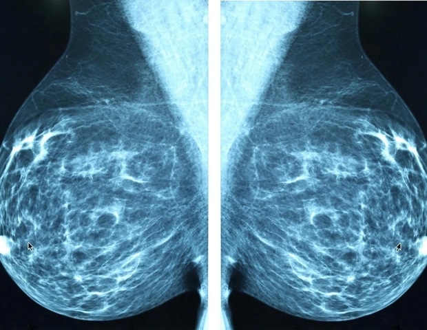 New dual-drug strategy blocks triple-negative breast cancer growth