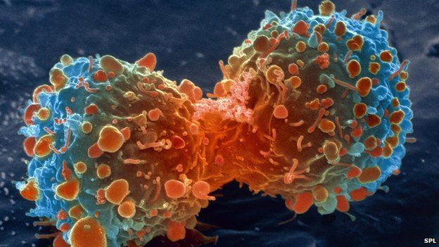 Pilots and Flight Attendants Show Elevated Radiation-Related Cancer Mortality
