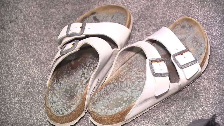Charlotte's shoes had been covered in mould.