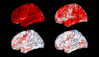 Neuropsychiatric MRI brain signatures fail reproducibility test