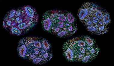 Five-year-old human brain organoids aged on schedule