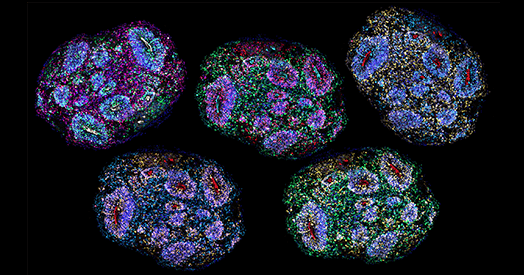 Five-year-old human brain organoids aged on schedule