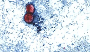 US reports first deaths linked to diarrhoea-causing parasite