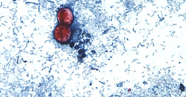 US reports first deaths linked to diarrhoea-causing parasite