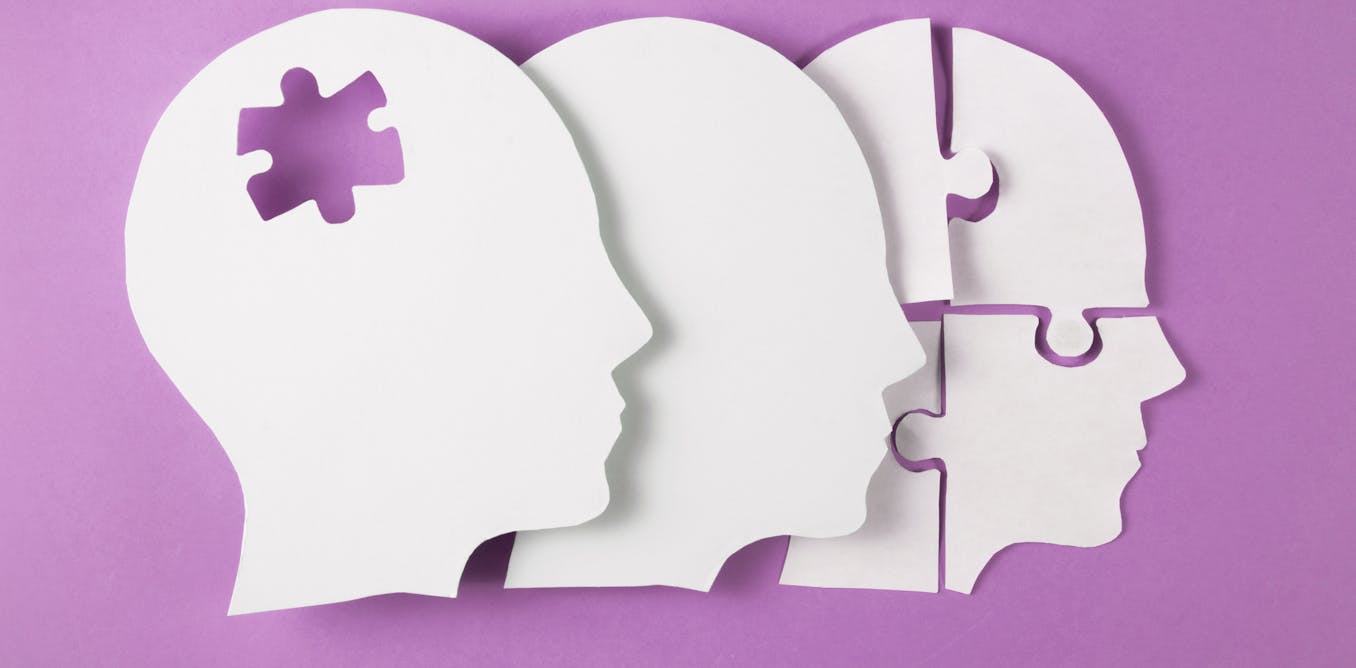 One of the most common brain disorders is one of the most misunderstood – how functional neurological disorder is both ‘all in your head’ and beyond it