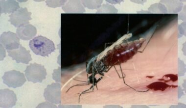 DRC reports 26 million malaria cases in 2025