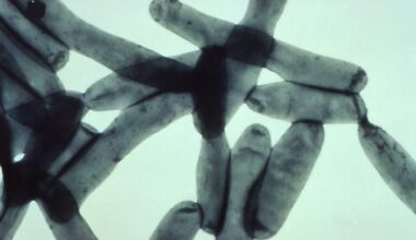 France: Legionnaires' disease surge in Savoie