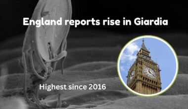 England reports increase in Giardia infections