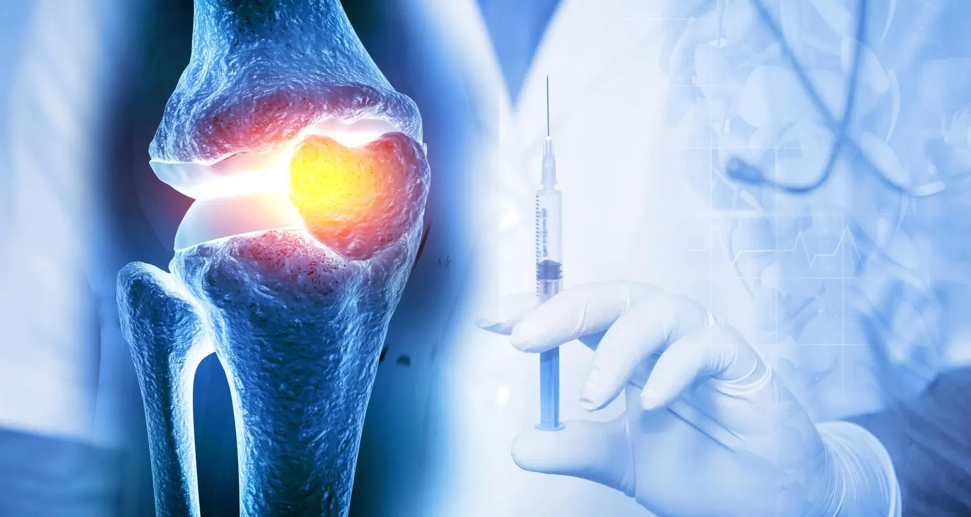 One injection could keep osteoarthritis drugs working for weeks