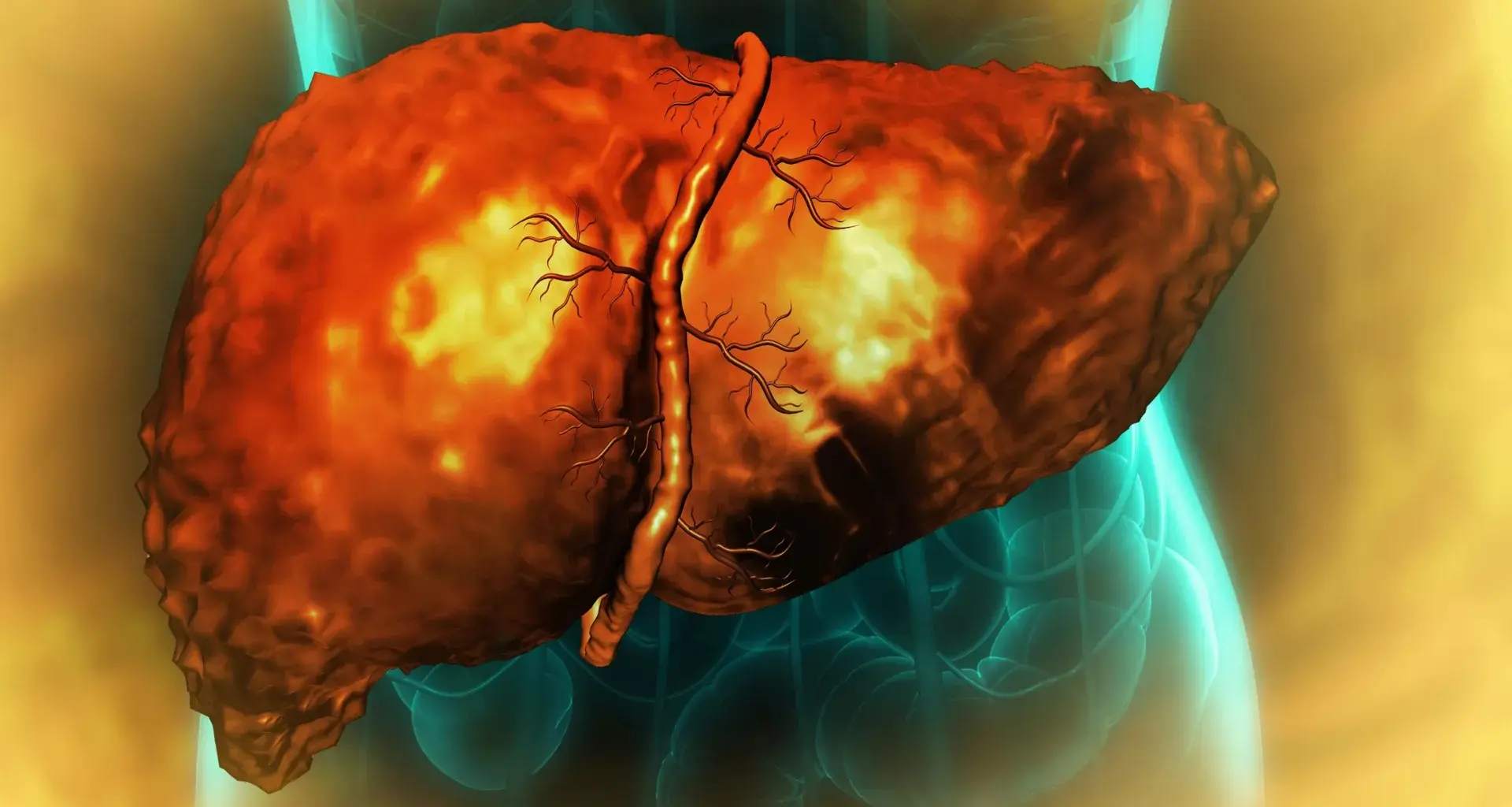 Scientists find why the liver may not heal even after you stop drinking