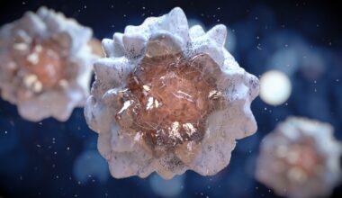 Immune Cell Dysfunction Not Absence Defines Nonmelanoma Skin Cancer in Immunosuppressed Patients