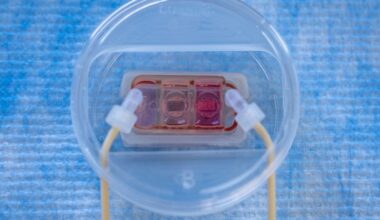A new chip can mimic how cancer spreads to other organs