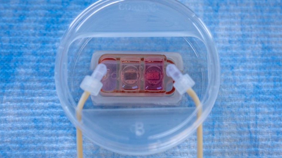 A new chip can mimic how cancer spreads to other organs