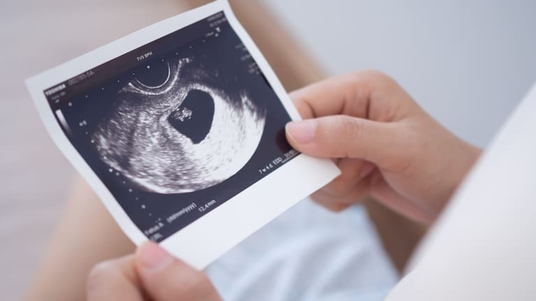 A ultra sound picture of a baby