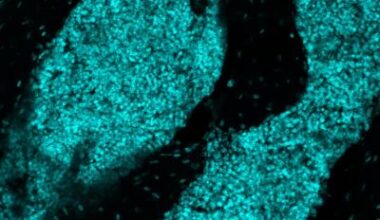 ‘Immune organ’ inside skull could help fight brain cancer • healthcare-in-europe.com