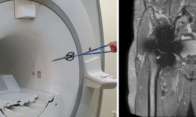 When metal meets magnet: Implant safety in MRI • healthcare-in-europe.com