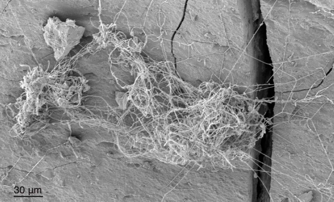 Rock-Eating Fungus Ecosystems Complete With Tardigrades And Worms Are Thriving Deep Within a Gas Shale