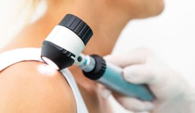 Funding for more local GPs to remove suspected skin cancer