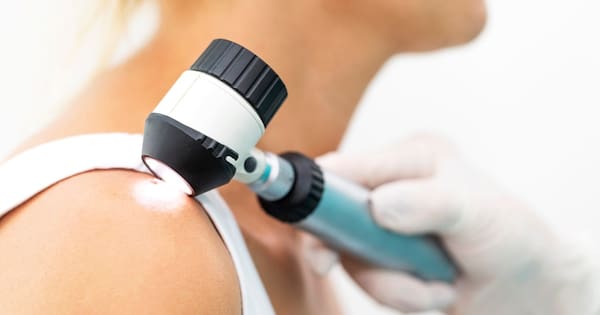 Funding for more local GPs to remove suspected skin cancer