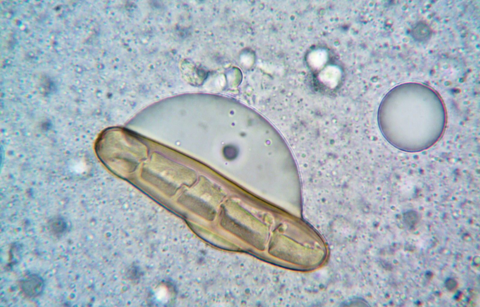 Tardigrades pulled from Antarctic moss can survive a decade without water, temperatures near absolute zero, and a 10-day exposure to the open vacuum of space in 2007, curling into a dehydrated husk they call a tun until conditions improve