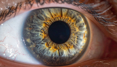 In 2017, a young woman glanced at a solar eclipse for only a handful of seconds, and days later doctors found the exact shape of the eclipse burned into the back of her eye. What she began drawing to describe her ruined vision matched that shape almost perfectly.