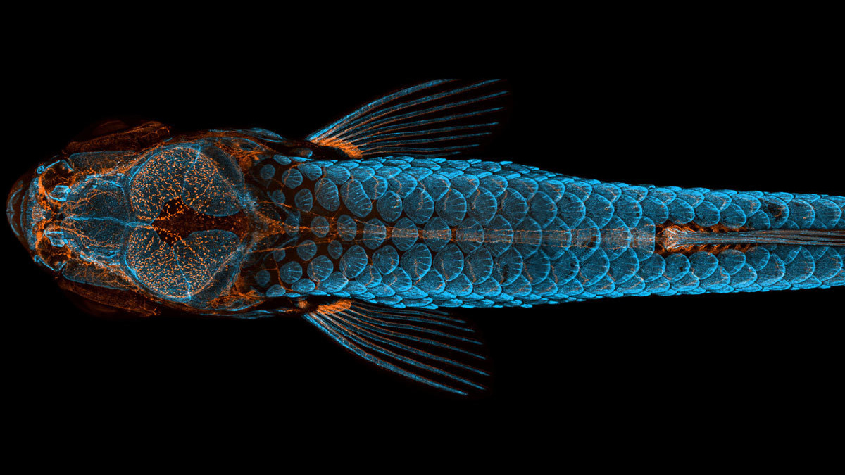Microscope image showing Dorsal view of bones and scales (blue) and lymphatic vessels (orange) in a juvenile zebrafish