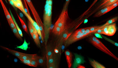 DNA repair protein boosts muscle endurance in aging mice