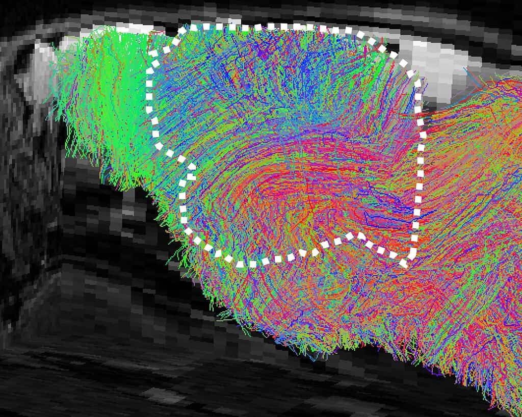 Image of overlapping colourful lines on a grey and black pixelated background. mouse brain nerve fibers