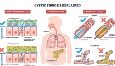 Suppressor tRNAs and lipid nanoparticles offer new approach to nonsense mutation cystic fibrosis