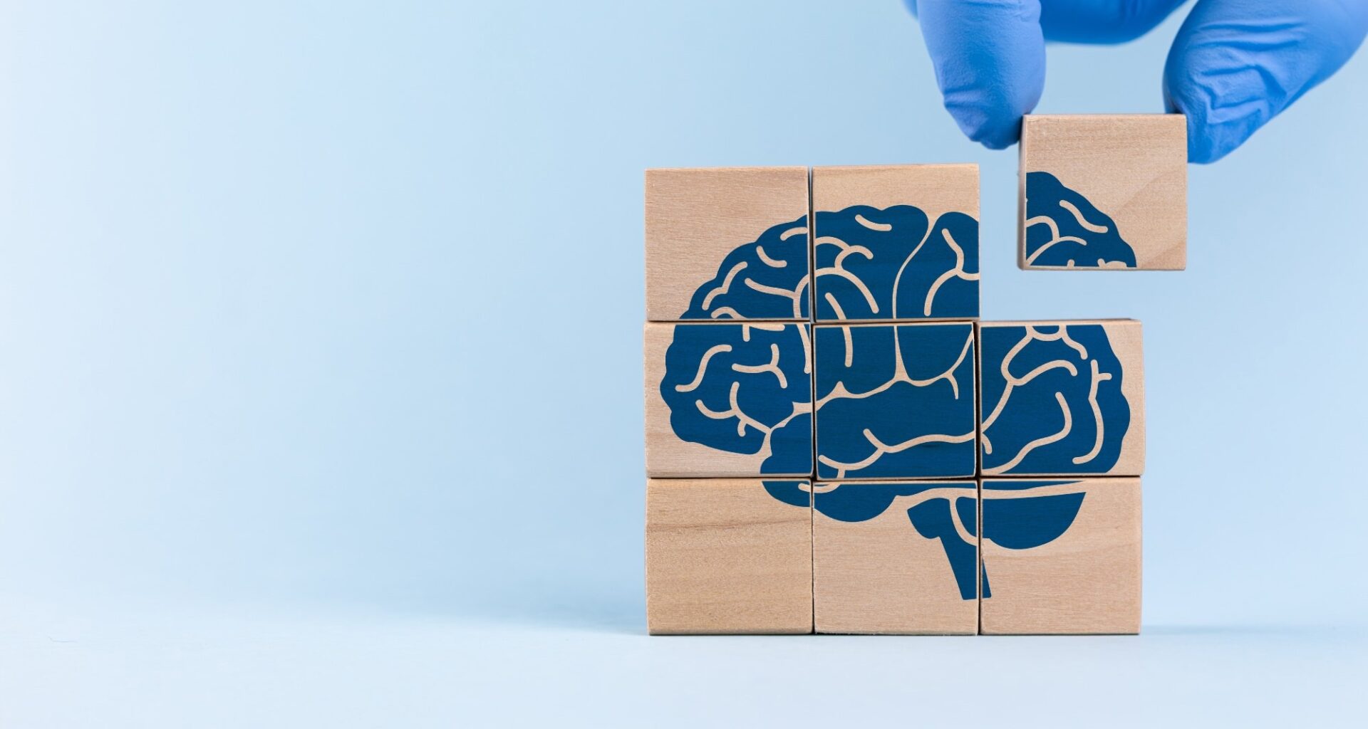 Study: Priming of CD8+ T cells by peripheral dendritic cells exacerbates tau-mediated neurodegeneration. Image Credit: Antonio Marca / Shutterstock