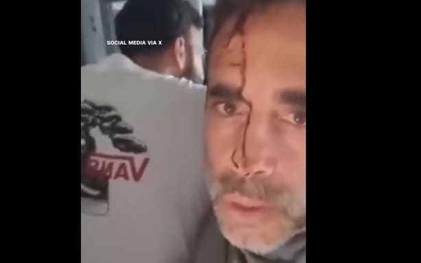 Bloody passenger on flydubai flight pleads for help.