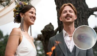 Newlyweds allegedly attacked in their sleep, groom left with broken eye socket