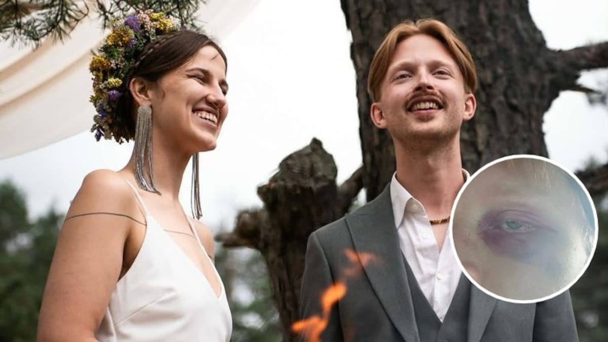 Newlyweds allegedly attacked in their sleep, groom left with broken eye socket