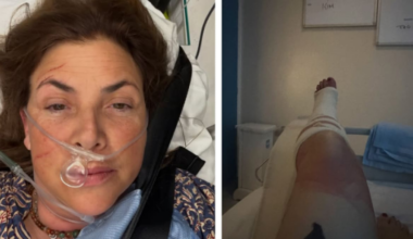 UK TV presenter Kirstie Allsopp rushed to hospital after fall during family holiday